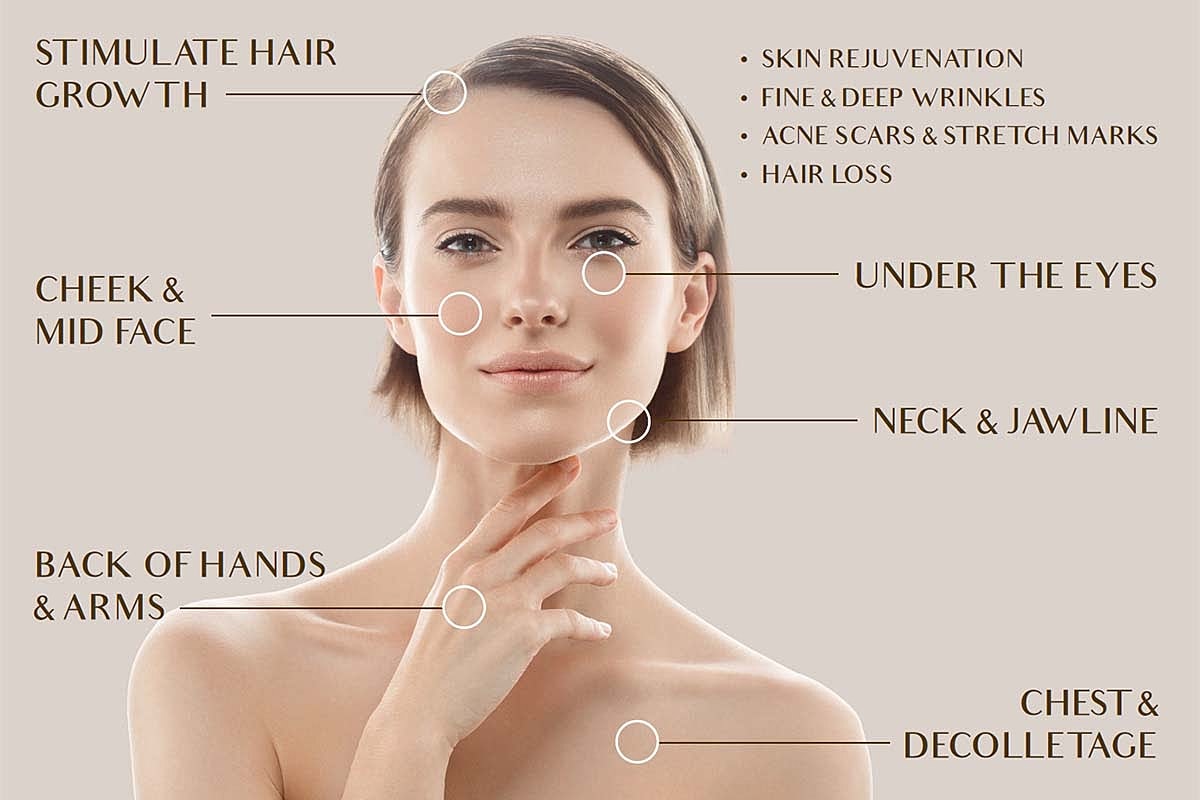 Facial areas highlighted for skincare treatments.