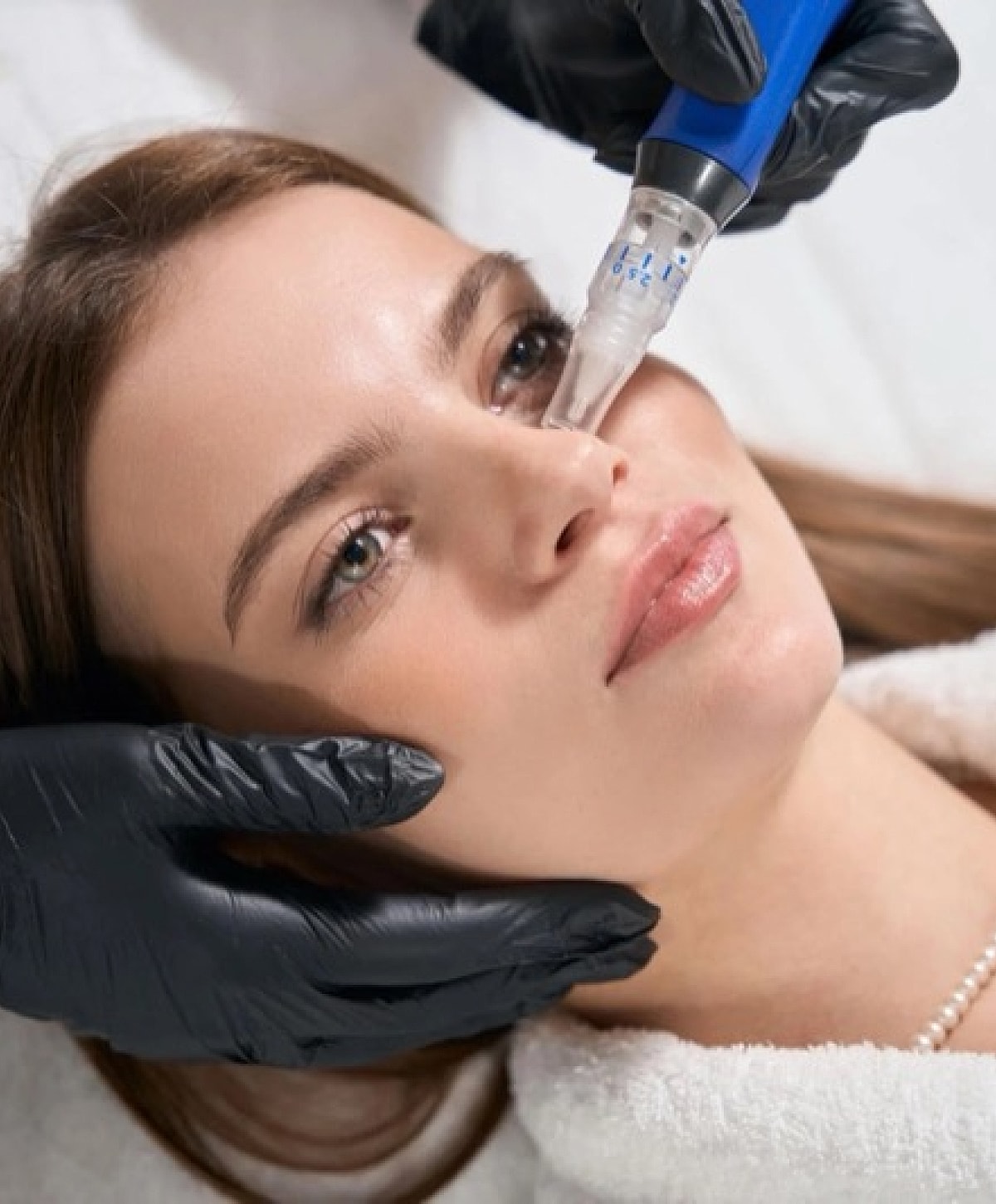 Micro-needling facial treatment on a young woman.