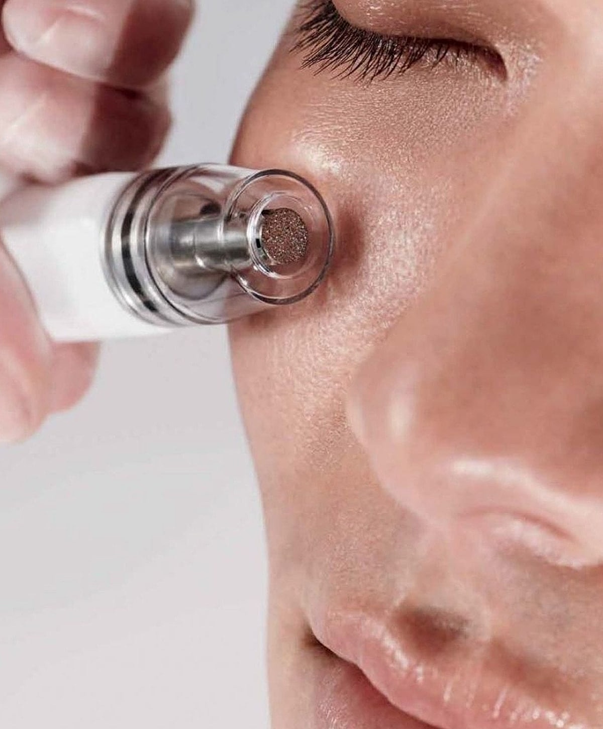 Skincare treatment using microdermabrasion device.